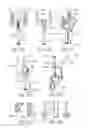 Fig. 45 - Intraoperative alignment assessment system and method