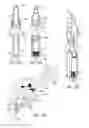 Fig. 49 - Intraoperative alignment assessment system and method