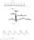 Fig. 02 - WEARABLE NARCOSIS ALERT
