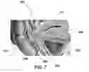 Fig. 05 - Vaginal ring sensor