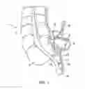 Fig. 02 - Method of removing an appendix