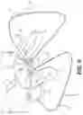 Fig. 07 - Control assemblies for medical devices and related methods of use