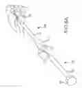 Fig. 07 - Facet joint implants and delivery tools