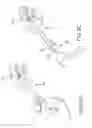Fig. 08 - Facet joint implants and delivery tools