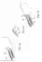 Fig. 13 - Facet joint implants and delivery tools