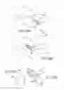 Fig. 29 - Facet joint implants and delivery tools
