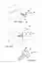 Fig. 33 - Facet joint implants and delivery tools