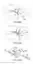 Fig. 47 - Facet joint implants and delivery tools
