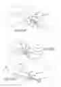 Fig. 48 - Facet joint implants and delivery tools