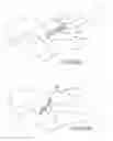 Fig. 49 - Facet joint implants and delivery tools