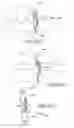 Fig. 52 - Facet joint implants and delivery tools