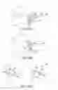 Fig. 70 - Facet joint implants and delivery tools