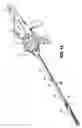 Fig. 02 - Surgical stapler with universal articulation and tissue pre-clamp