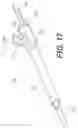 Fig. 17 - Growing rod for treating spinal deformities and method for using same