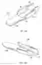 Fig. 06 - Electrosurgical resection instrument