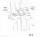 Fig. 07 - Method for determining a parameter which is indicative for the position and apposition of a tubular member, such as a stent graft, inserted in a lumen of an anatomical vessel or duct of a patient