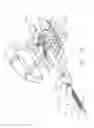Fig. 33 - Surgical instrument with wireless communication between a control unit of a robotic system and remote sensor