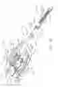 Fig. 35 - Surgical instrument with wireless communication between a control unit of a robotic system and remote sensor