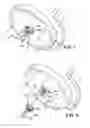 Fig. 02 - Handle assembly for a surgical lighting system