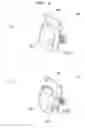 Fig. 07 - Dental brace and method for attaching dental brace