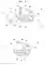 Fig. 08 - Dental brace and method for attaching dental brace