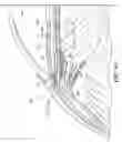 Fig. 07 - Accommodating intraocular lens assembly