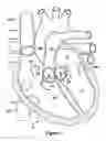 Fig. 02 - Native valve repair devices and procedures