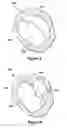 Fig. 04 - Native valve repair devices and procedures