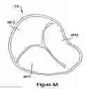 Fig. 05 - Native valve repair devices and procedures