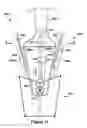 Fig. 12 - Native valve repair devices and procedures