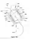 Fig. 17 - Native valve repair devices and procedures