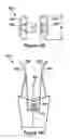 Fig. 20 - Native valve repair devices and procedures