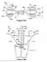 Fig. 22 - Native valve repair devices and procedures