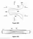 Fig. 28 - Native valve repair devices and procedures