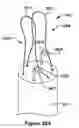 Fig. 41 - Native valve repair devices and procedures