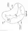 Fig. 46 - Native valve repair devices and procedures