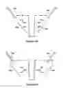 Fig. 47 - Native valve repair devices and procedures