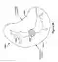 Fig. 56 - Native valve repair devices and procedures