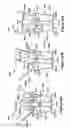 Fig. 43 - Native valve repair devices and procedures