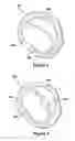 Fig. 04 - Native valve repair devices and procedures