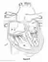 Fig. 06 - Native valve repair devices and procedures