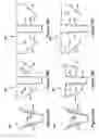Fig. 48 - Native valve repair devices and procedures