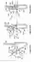 Fig. 71 - Native valve repair devices and procedures