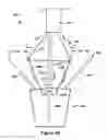 Fig. 74 - Native valve repair devices and procedures