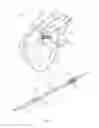 Fig. 02 - Heart valve prosthesis