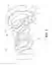 Fig. 02 - Universal low-profile intercranial assembly