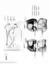 Fig. 04 - SYSTEMS AND METHODS OF IMPLANTS TO RESTORE PATIENT SPECIFIC FUNCTON