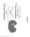 Fig. 10 - SYSTEMS AND METHODS OF IMPLANTS TO RESTORE PATIENT SPECIFIC FUNCTON