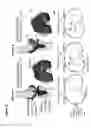 Fig. 16 - SYSTEMS AND METHODS OF IMPLANTS TO RESTORE PATIENT SPECIFIC FUNCTON