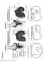 Fig. 17 - SYSTEMS AND METHODS OF IMPLANTS TO RESTORE PATIENT SPECIFIC FUNCTON